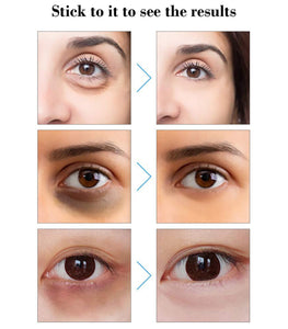Hyaluronic Acid Micro-Needle Eye Patch 5 Boxes (10 PCS ) dylinoshop