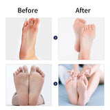 Electric Feet Callus Remover DYLINOSHOP