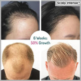 Scalp Intense™ - Hair Growth Serum dylinoshop