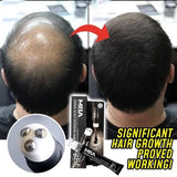 Scalp Intense™ - Hair Growth Serum dylinoshop
